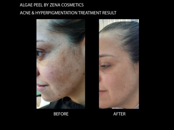 Zena Natural Peeling Algae 1 Box - Image 3