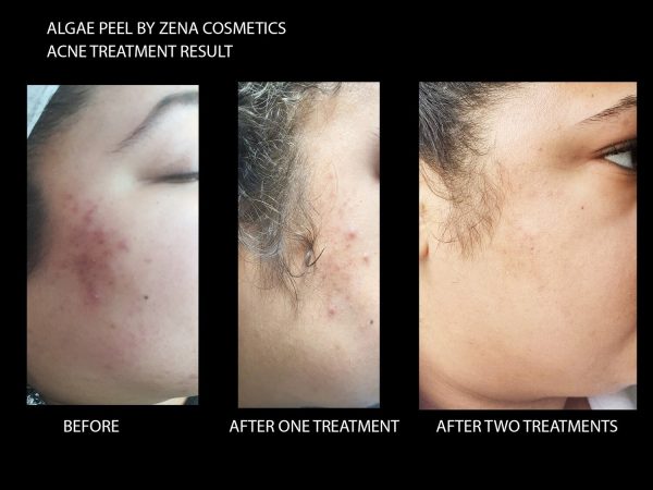 Zena Natural Peeling Algae 1 Box - Image 2